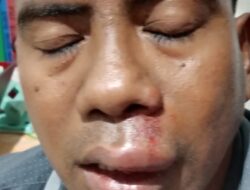 Diduga Dianiaya di Aula Paroki Kaputu, Warga Malaka Lapor ke Polisi, Desak Proses Hukum Dipercepat